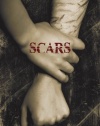 Scars