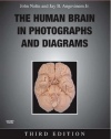 The Human Brain in Photographs and Diagrams with CD-ROM, 3e