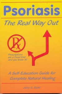 Psoriasis: The Real Way Out: A Self-Education Guide to Complete Natural Healing