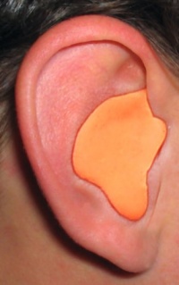 Radians Custom Molded Earplugs