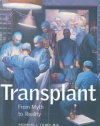 Transplant: From Myth to Reality