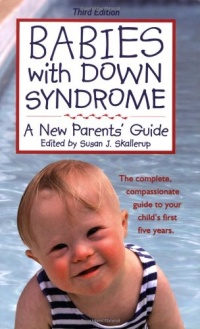 Babies with Down Syndrome: A New Parents' Guide