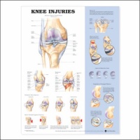 Knee Injuries Anatomical Chart Unmounted-9872PU